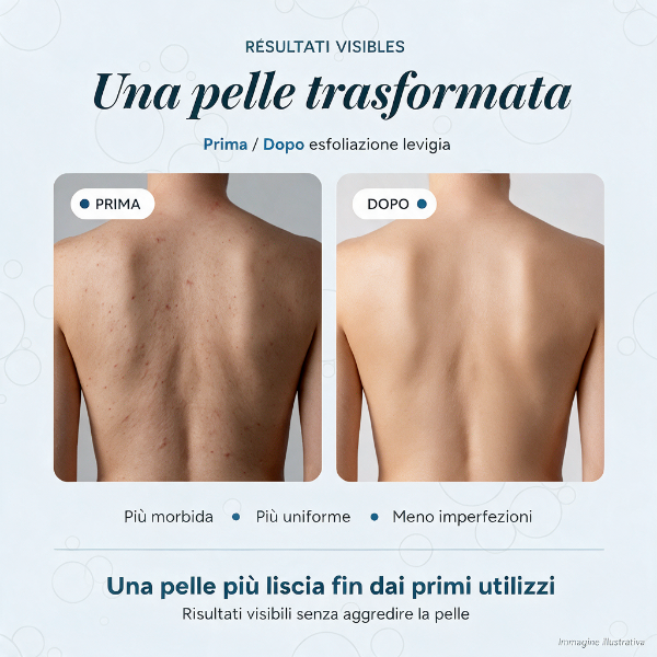 Telo Esfoliante levigia — con impugnature